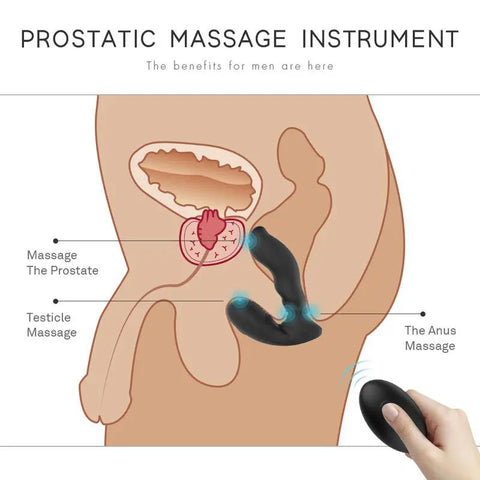 Remote Control G-Spot Prostate Stimulator  Fizzglow